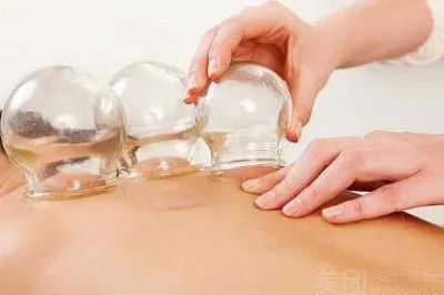 刮痧拔罐真的能祛除体内湿气吗